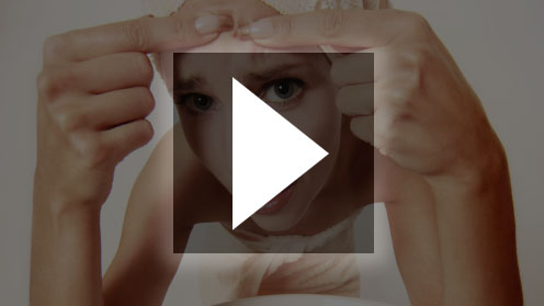 acne Treating Acne At Home: Save Your Money!